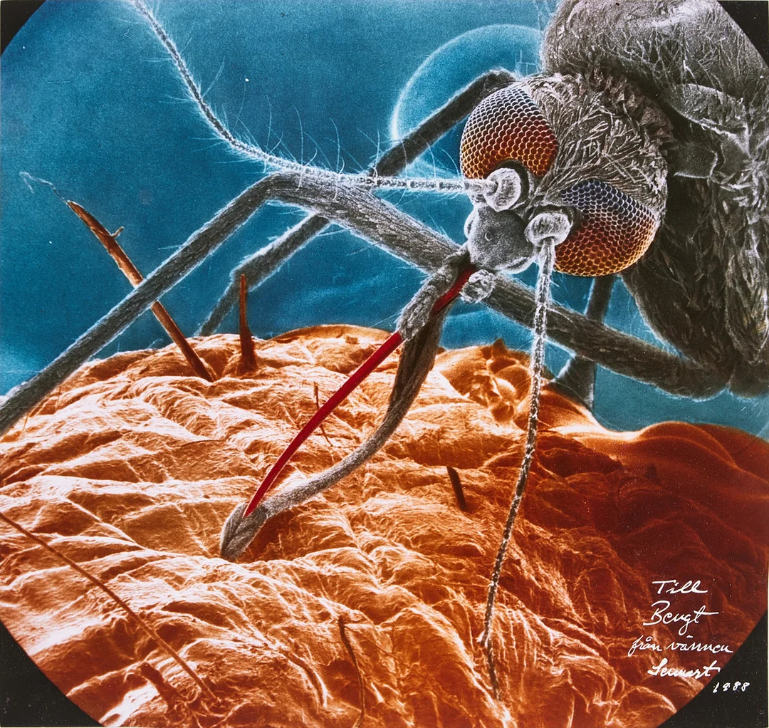 LENNART NILSSON. fototryck, uppfodrad på pannå, signerad av Lennart Nilsson och daterad 1988. — Photography — Stockholms Auktionsverk Magasin 5