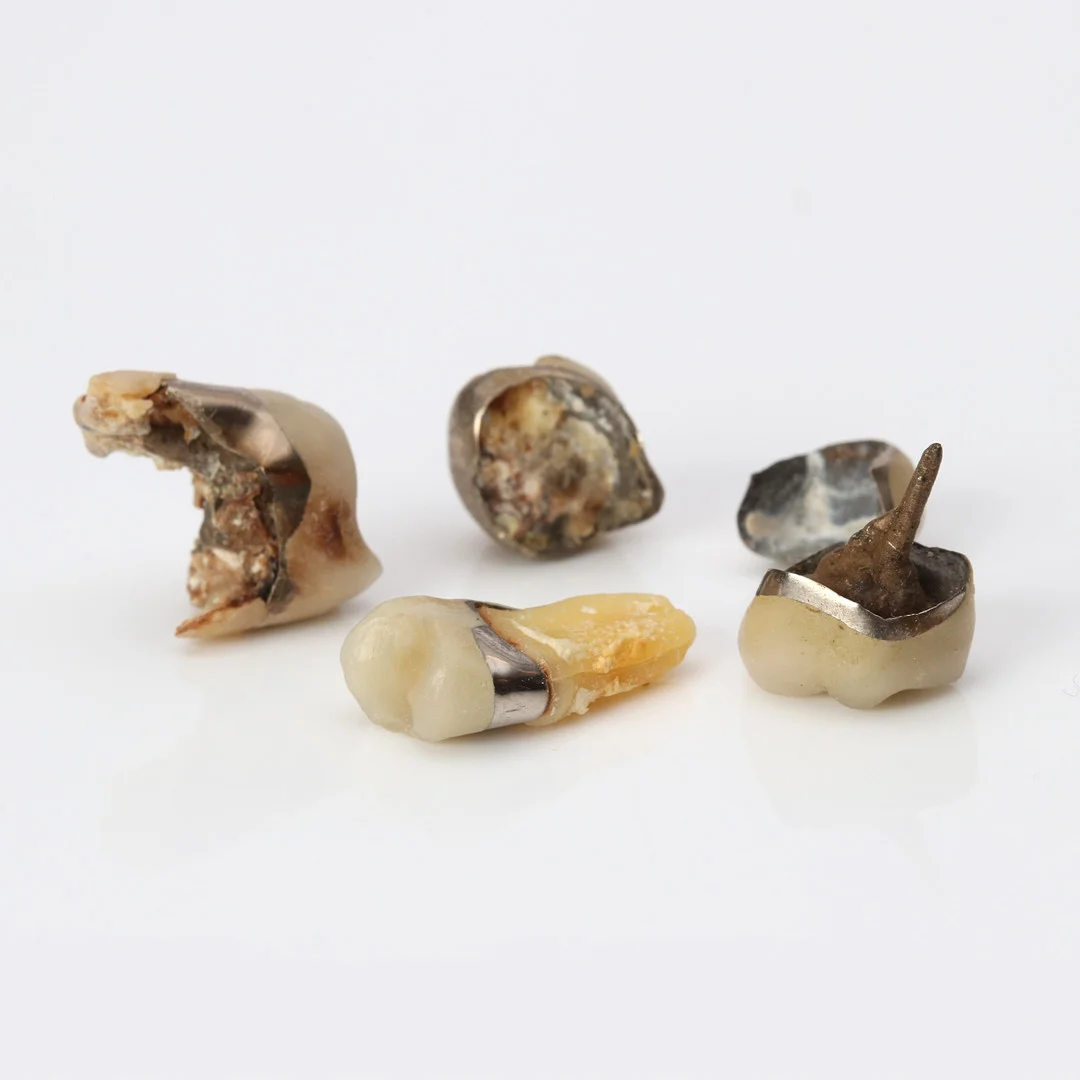 TANDGULD. Orensat ca 18k guld, totalvikt ca 13,4 gram. — Objet de vertu & Miscellaneous — Skånes Auktionsverk