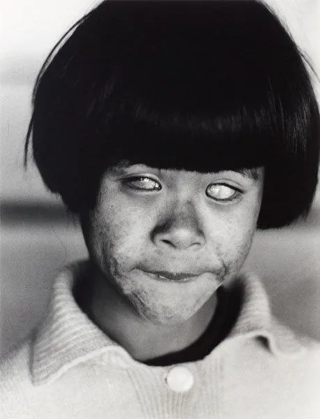 Christer Strömholm, "Hiroshima-sviten", 1963 (22 st).